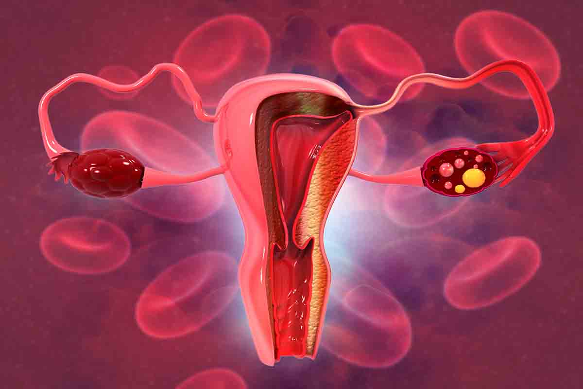 Pendarahan Implantasi vs. Menstruasi: Seperti Apa Pendarahan Implantasi Itu? =